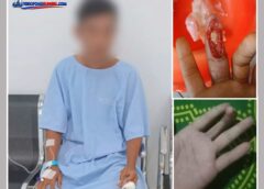 Jari Cacat Diduga Akibat Kecelakaan Kerja, Warga PALI Mengaku Malah Di-PHK PT MSK, Subkon PKS PT Abuhrami